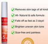 Tags & Moles Remover (Pack of 2) Beauty & Personal Care