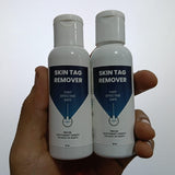 Skin Tag Remover 100 ml Pack of 2 Beauty & Personal Care