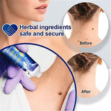 WartsOff Instant Blemish Removal Cream Pack of 2 Beauty & Personal Care