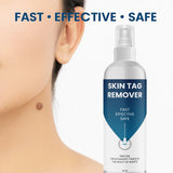 Skin Tag Remover 100 ml Pack of 2 Beauty & Personal Care